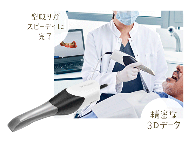 型取りがスピーディに完了／精密な3Dデータ