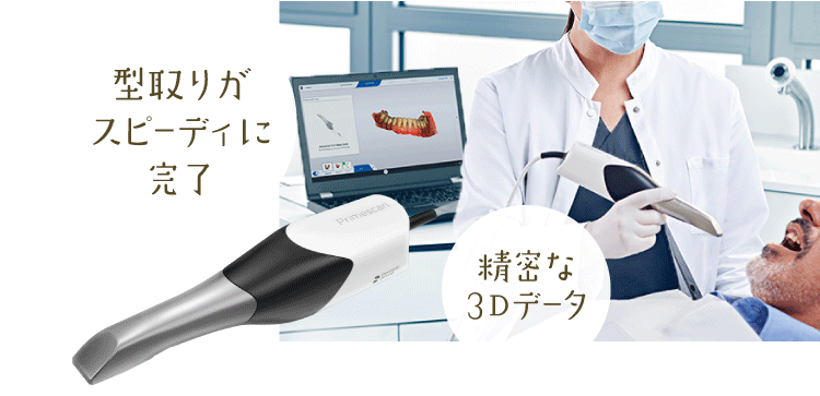 型取りがスピーディに完了／精密な3Dデータ