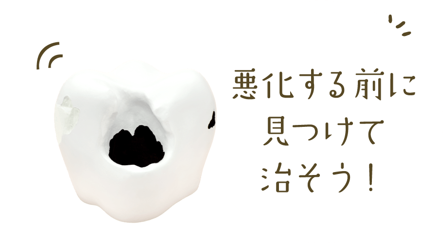 悪化する前に見つけて治そう！