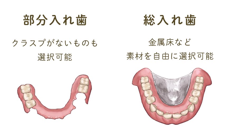 部分入れ歯】クラスプがないものも選択可能　【総入れ歯】金属床など素材を自由に選択可能